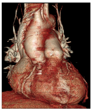 Cardio Imaging cardioexpert